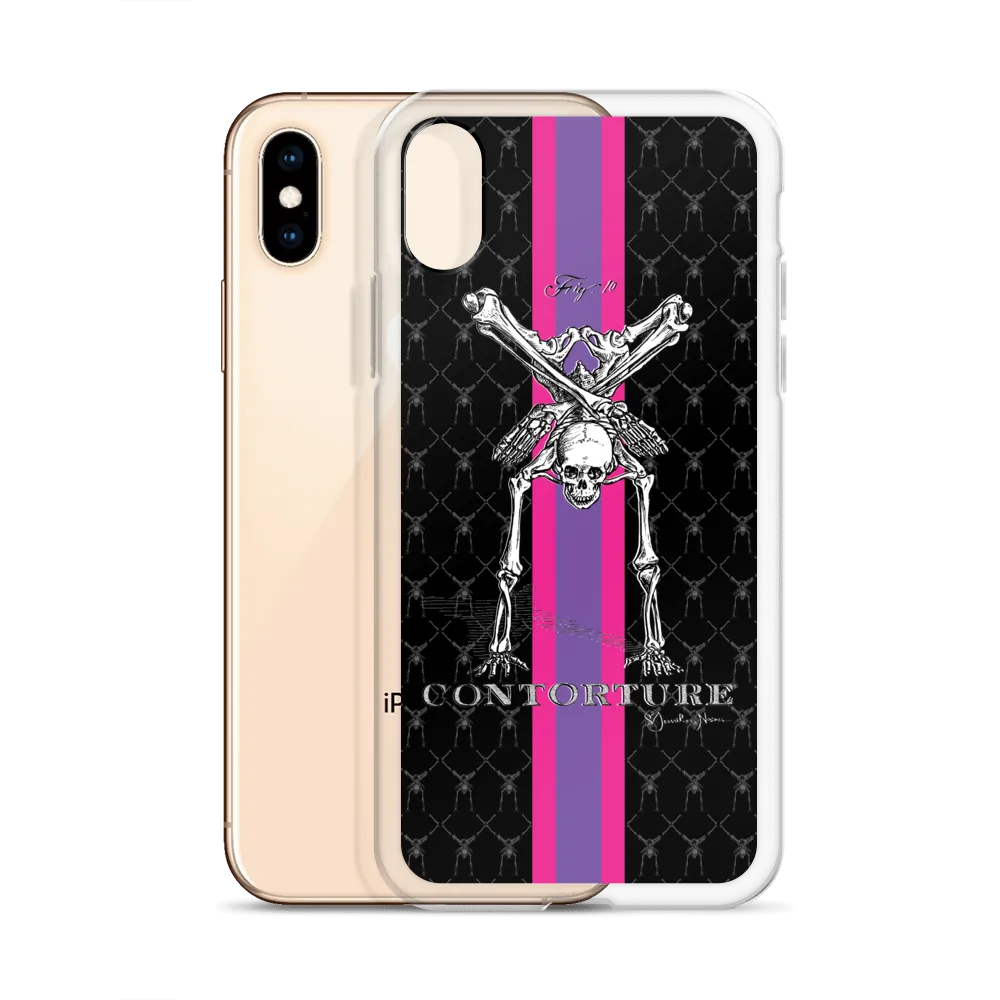 Contorture iPhone Case: SuperStripe Contortion Skeleton